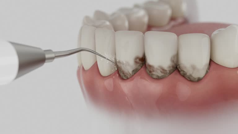 Reliable Dental Implants contractor in Patton Village, TX by Smile Center Dentistry
